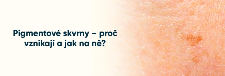 Skin pigmentation spots