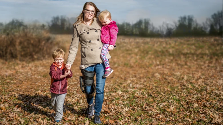Woman with injured leg walking outdoors
