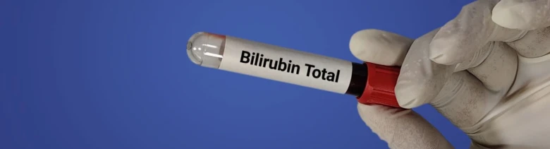 Krevní vzorek v testovací trubicí pro měření celkového bilirubinu.