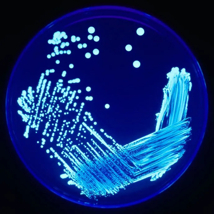 Kolonie bakterie Legionella na agarové desce pod ultrafialovým světlem.
