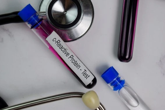 Krevní vzorek na testování CRP s fonendoskopem.