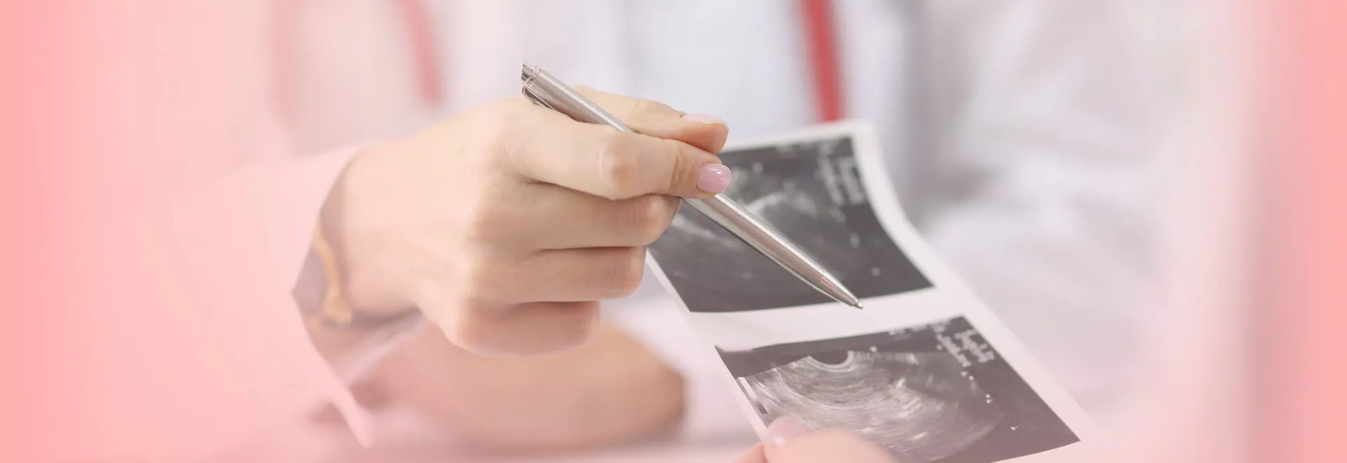Lékař ukazuje na ultrazvukový obraz při vysvětlování výsledků IVF.