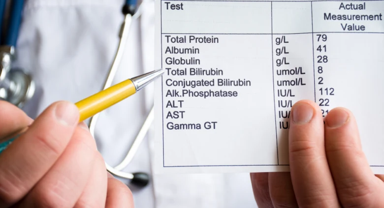 Laboratorní test s hodnotami bilirubinu pro lékařskou analýzu.