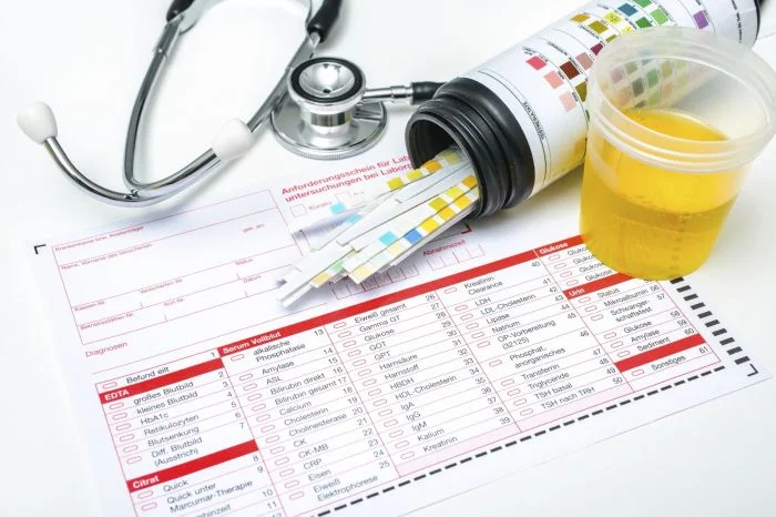 Krevní testy moči s kardiografem na českém formuláři pro laboratorní vyšetření.