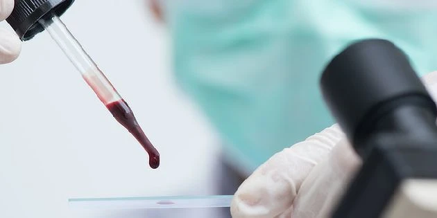 Blood sample drop pipette