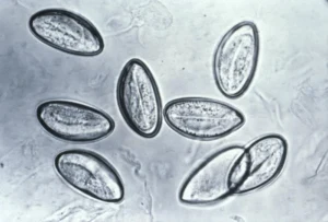 Mikroskopický pohled na vejce pinwomů Enterobius vermicularis.