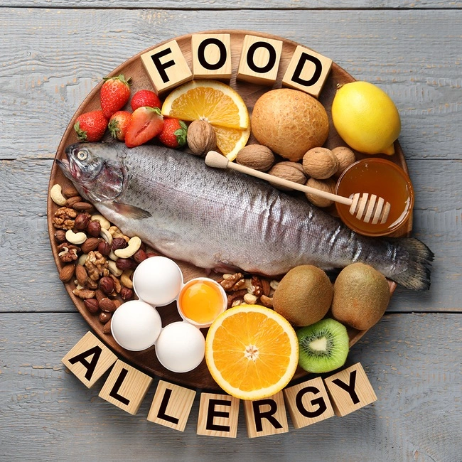 Různé potraviny na desce s textem FOOD ALLERGY pro alergie.
