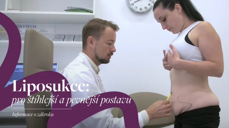 Lékař označuje pacientovi břicho pro liposukci v ordinaci.