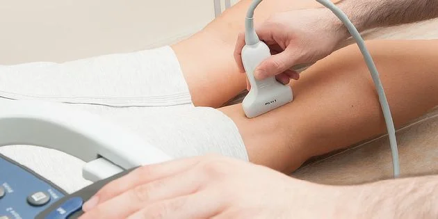 Ultrasound on leg vein