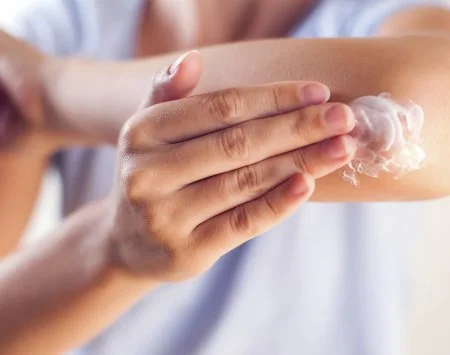 Osoba nanáší krém na předloktí při péči o atopický ekzém.