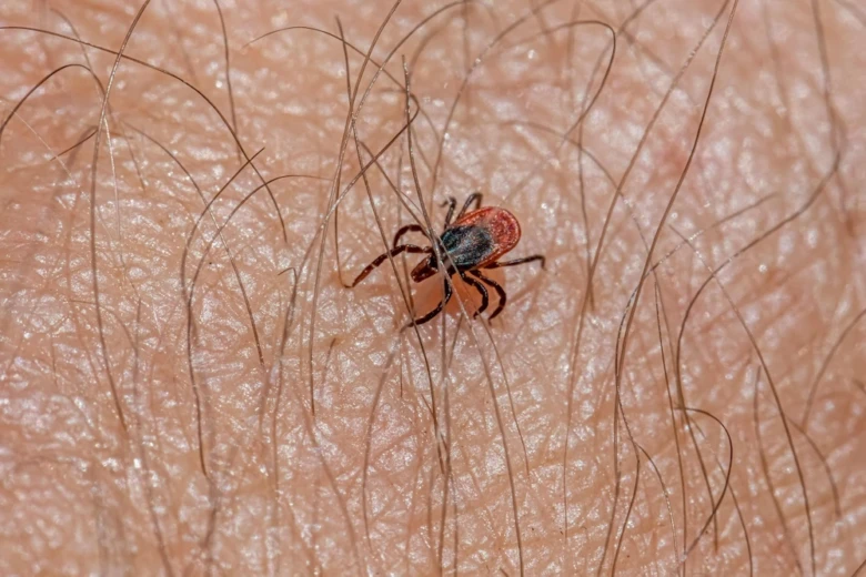 Klíště přisáté na lidskou kůži s viditelnými chlupy.