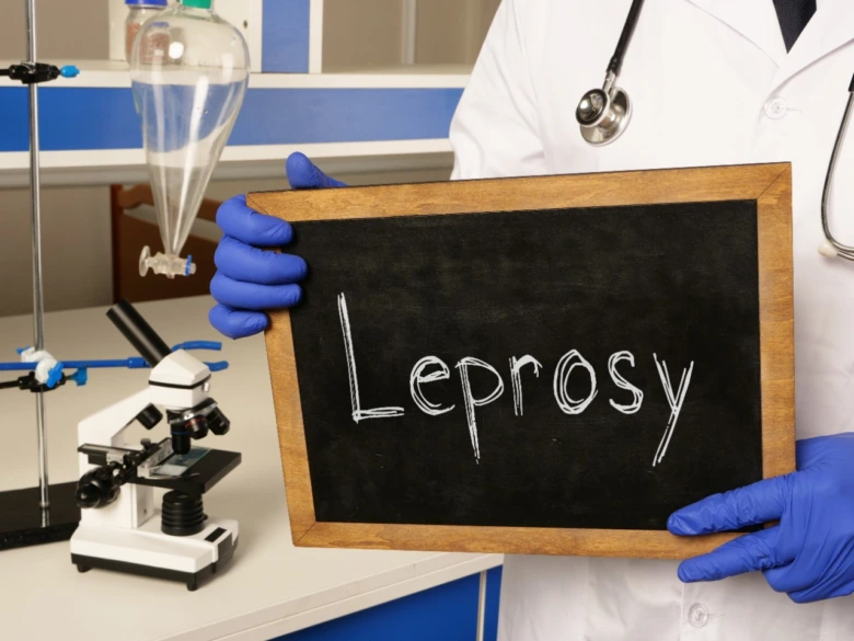 Lékař drží tabuli s nápisem malomocenství v laboratoři.