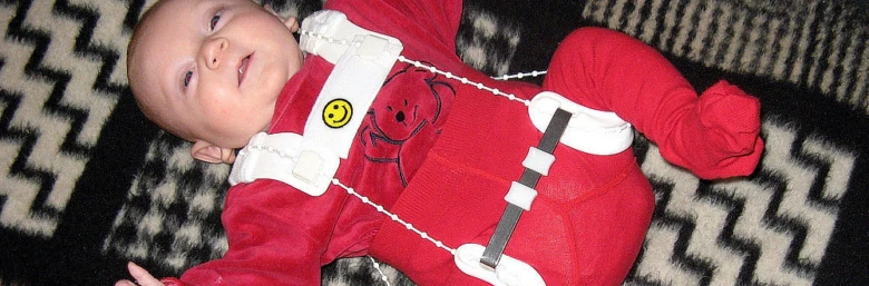 Baby in hip brace