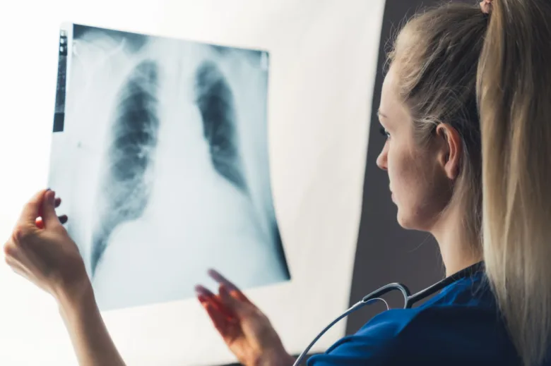 Lékařka zkoumá rentgenový snímek plic při diagnostice zápalu.