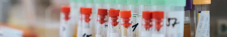 Blood test tubes in rack