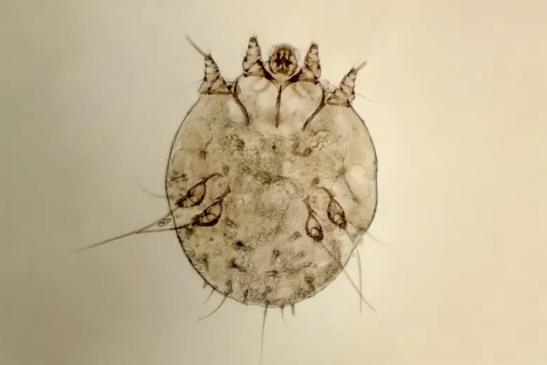 Mikroskopický záběr na svrabového roztoče pro ilustraci příznaků