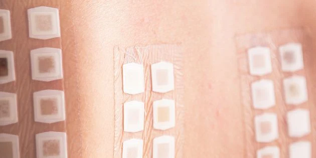 Skin patches on arm