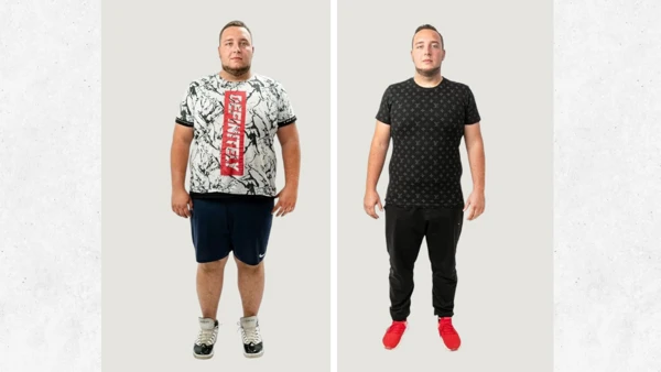 Man before and after weight loss