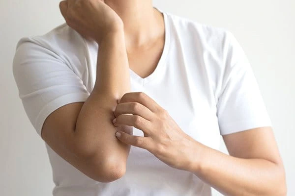 Person scratching elbow