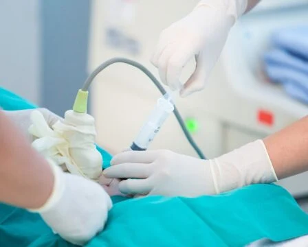 Gynekologické vyšetření s ultrazvukem při cystě na vaječníku