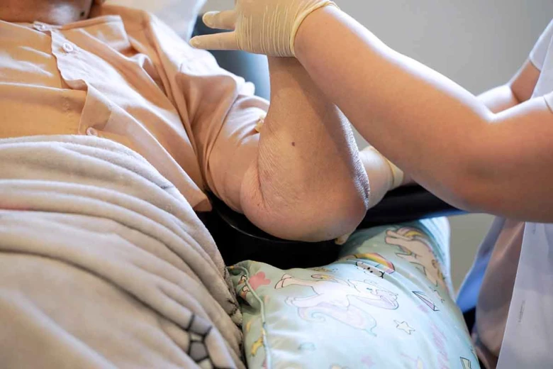 Přístroj pro péči o kůži pacienta v posteli s podezřením na dekubit.