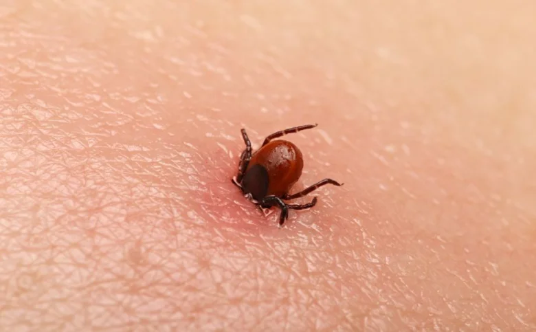 Hnědá klíště přichycené k lidské pokožce.