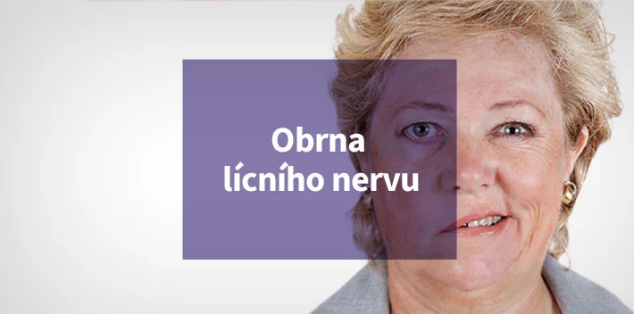Žena s příznaky obrny lícního nervu
